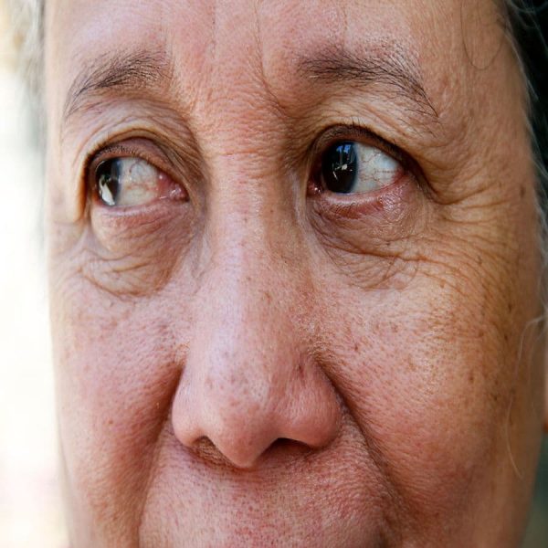 Is Clinical Hypnotherapy The Alternative Treatment Of Choice For Hot