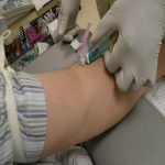 how to get over fear of needles and blood